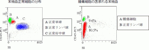 フローサイトメーター解析チャートの一例