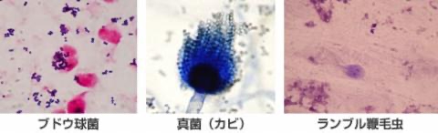 塗抹鏡検検査