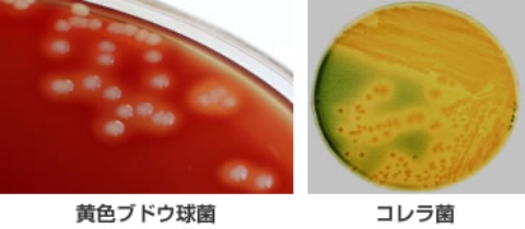培養・同定検査