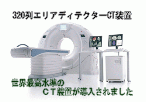 320列エリアディテクターCT装置