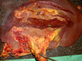 肝臓が腫大し、脂肪組織や肝臓の黄染がみられる写真です。