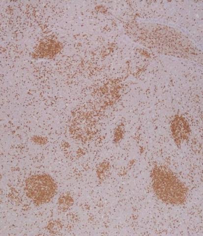 肝臓の切片を抗CD3免疫染色し、顕微鏡で拡大した画像です。