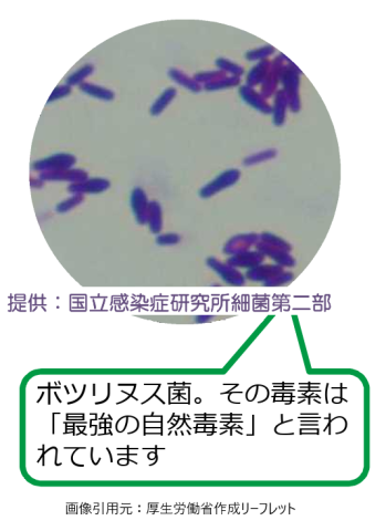 ボツリヌス菌の顕微鏡写真