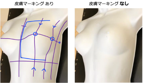 皮膚マーキングあり　なしの図
