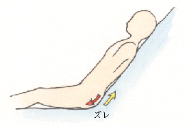 上方向と下方向へのズレ