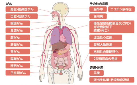 喫煙レベル1