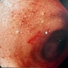 手術前 手術前の消化器の写真