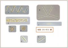 印旛沼で見られる珪藻綱のプランクトンの写真